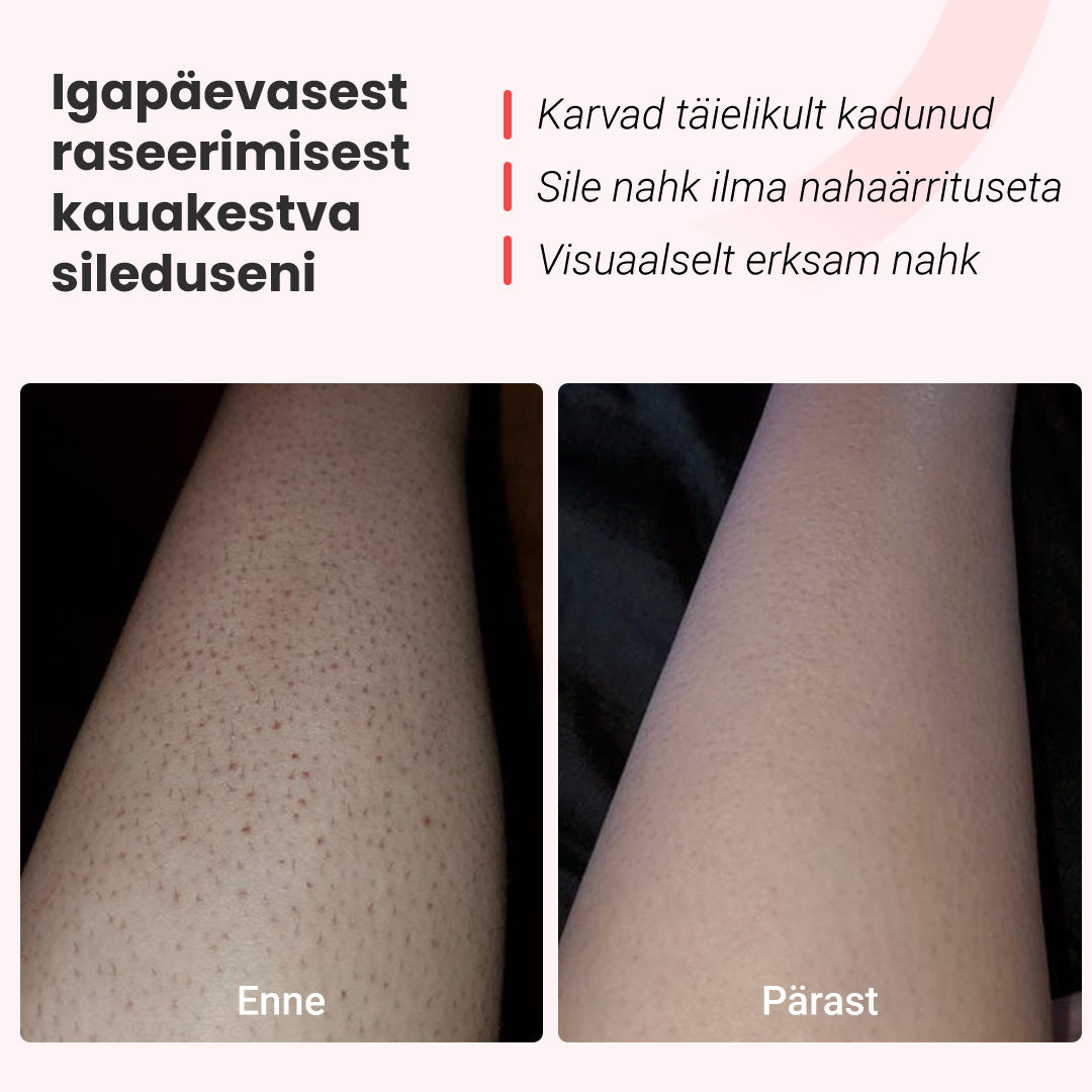 Fotoepilaator IPL